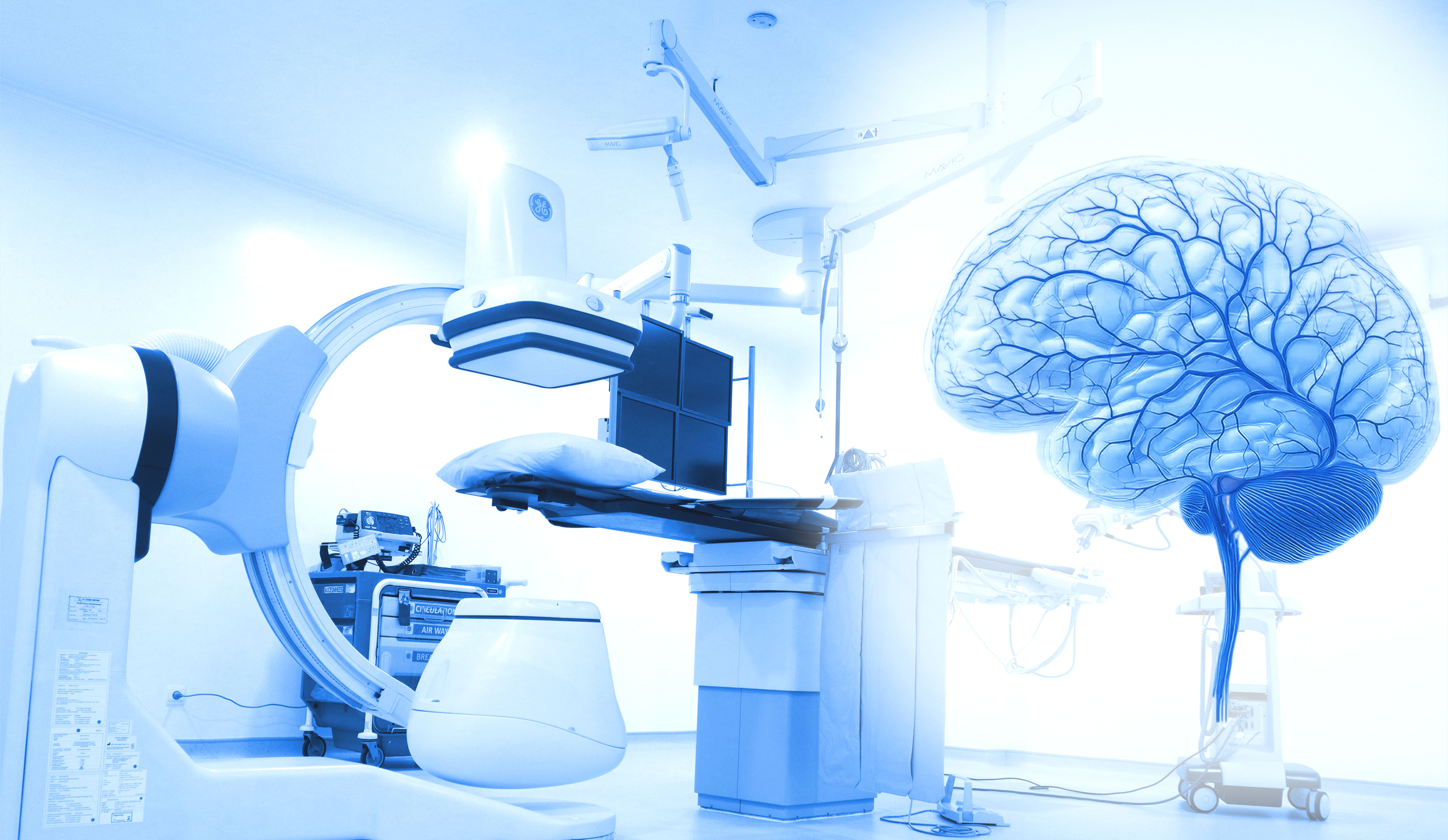 DSA Cerebral (Angiografi Otak)