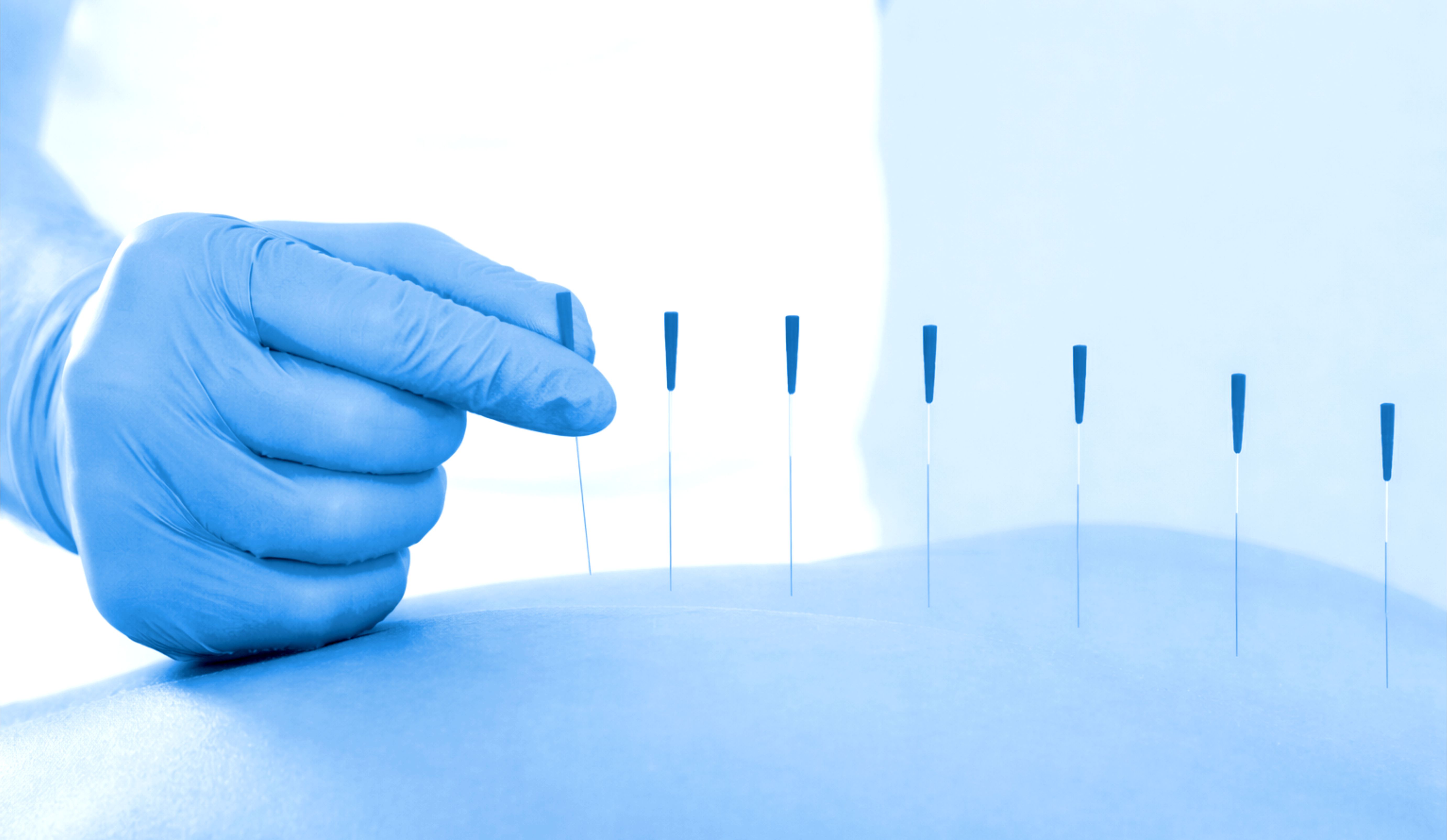 Klinik Akupunktur Medis